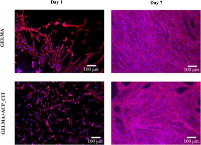 Development of nanocomposite hydrogel using citrate-containing amorphous calcium phosphate and gelatin methacrylate